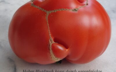 Blutdruck